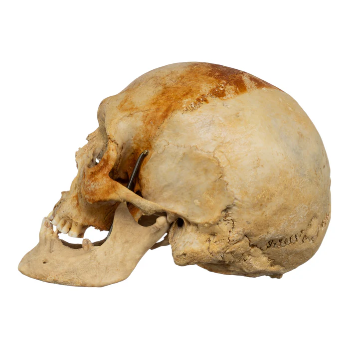 real-human-skull-GHS79253-side